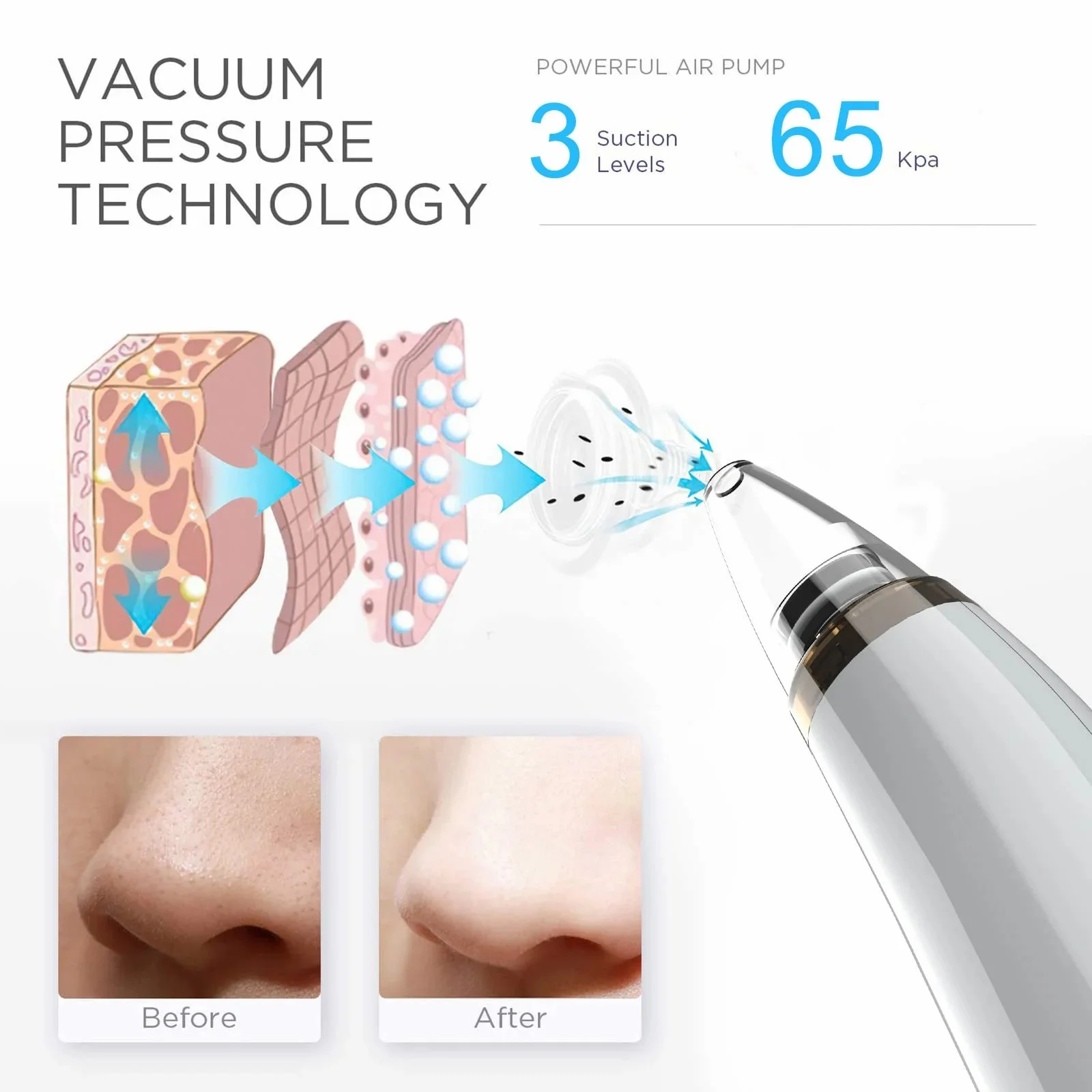 Electric Blackhead Pore Vacuum - Image 6