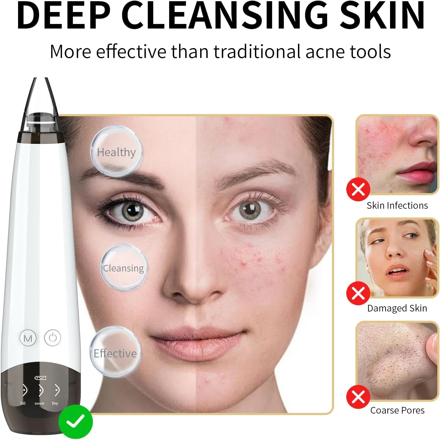 Electric Blackhead Pore Vacuum - Image 7