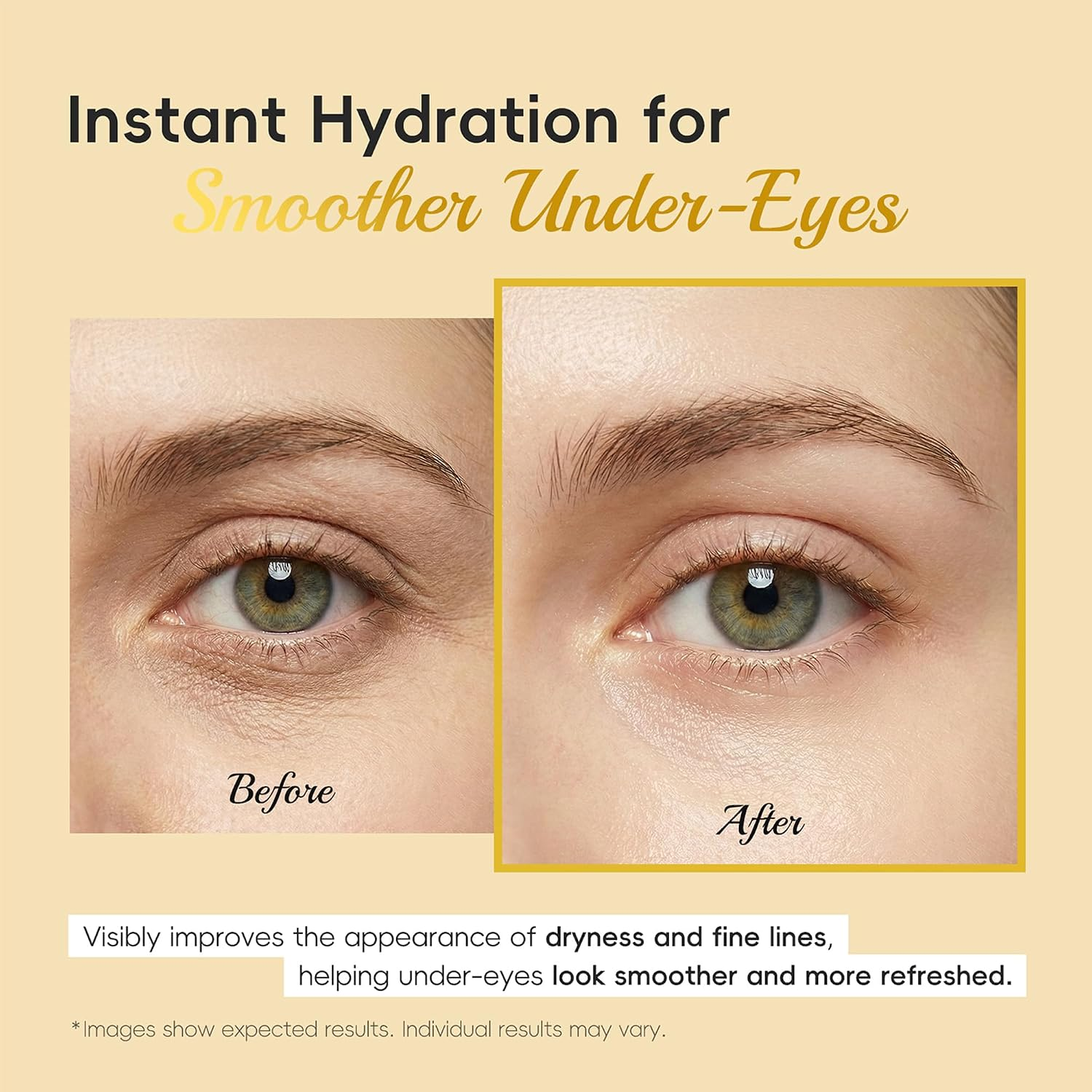 Snail Collagen Under-Eye Patches — Hydrating Masks for Dark Circles & Puffiness - Image 8